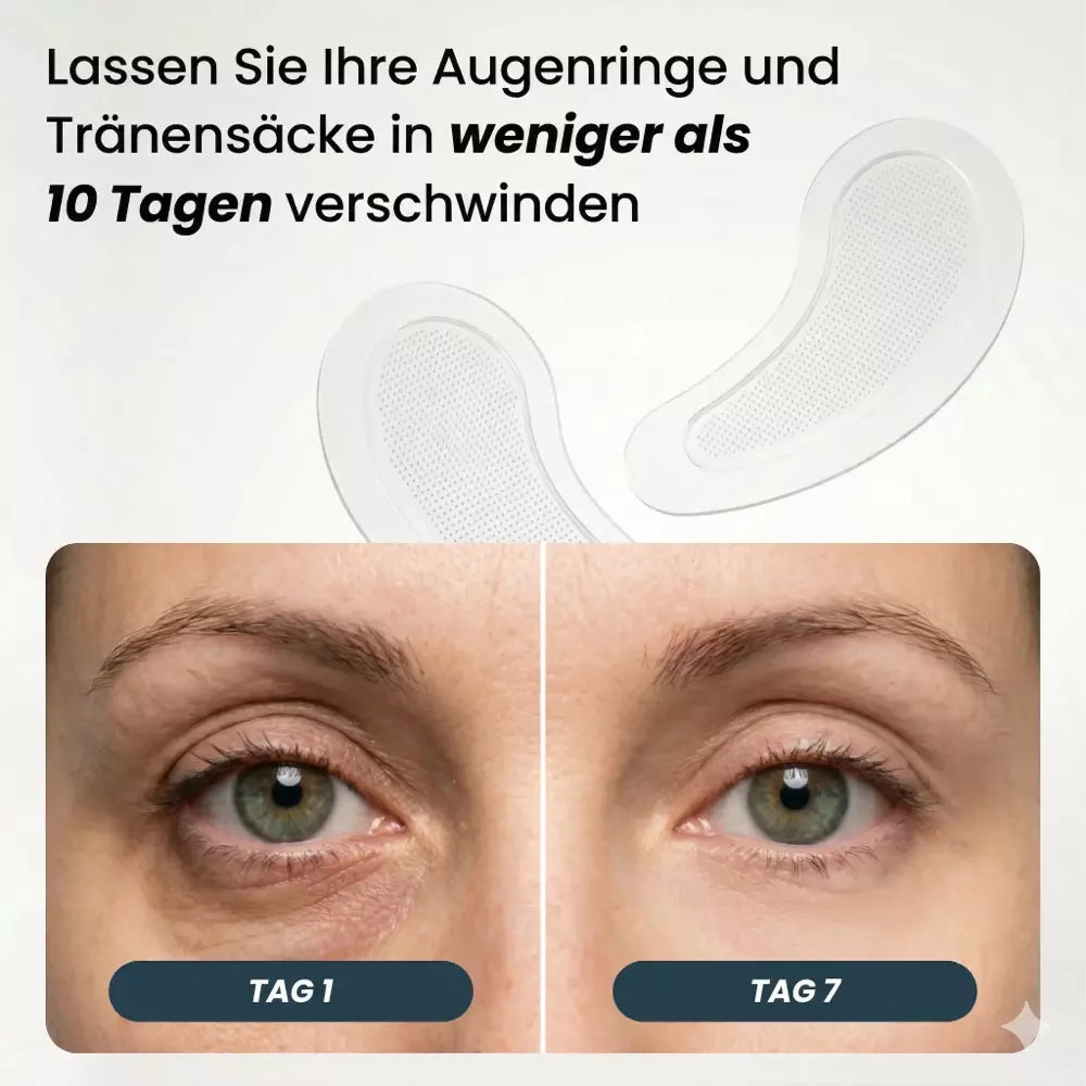 Auralis EyeLift Mikro-Pflaster