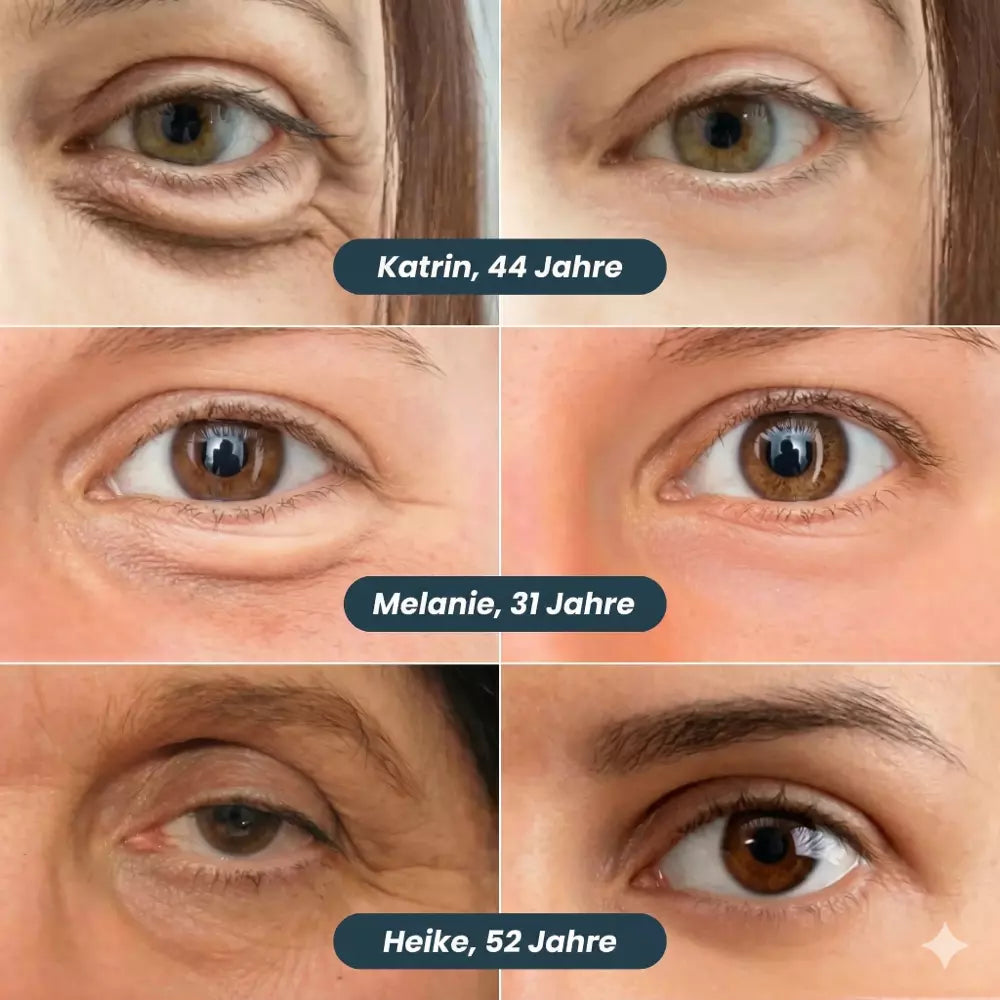 Auralis EyeLift Mikro-Pflaster